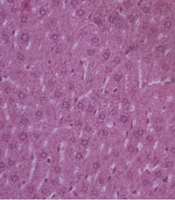 Jundishapur J Nat Pharm Prod